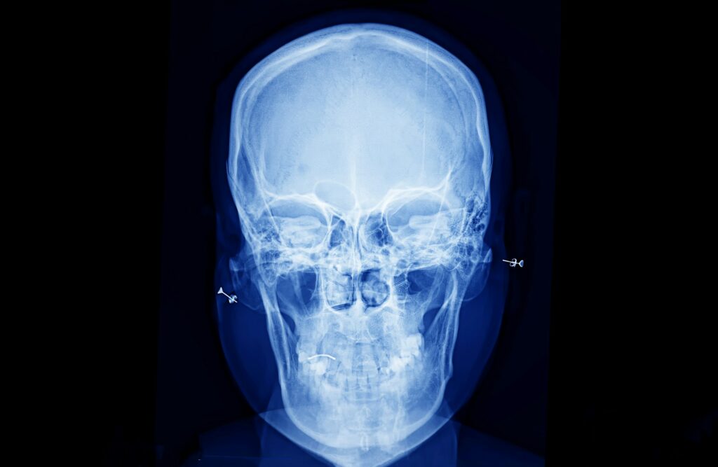 X-Ray film scan of human.